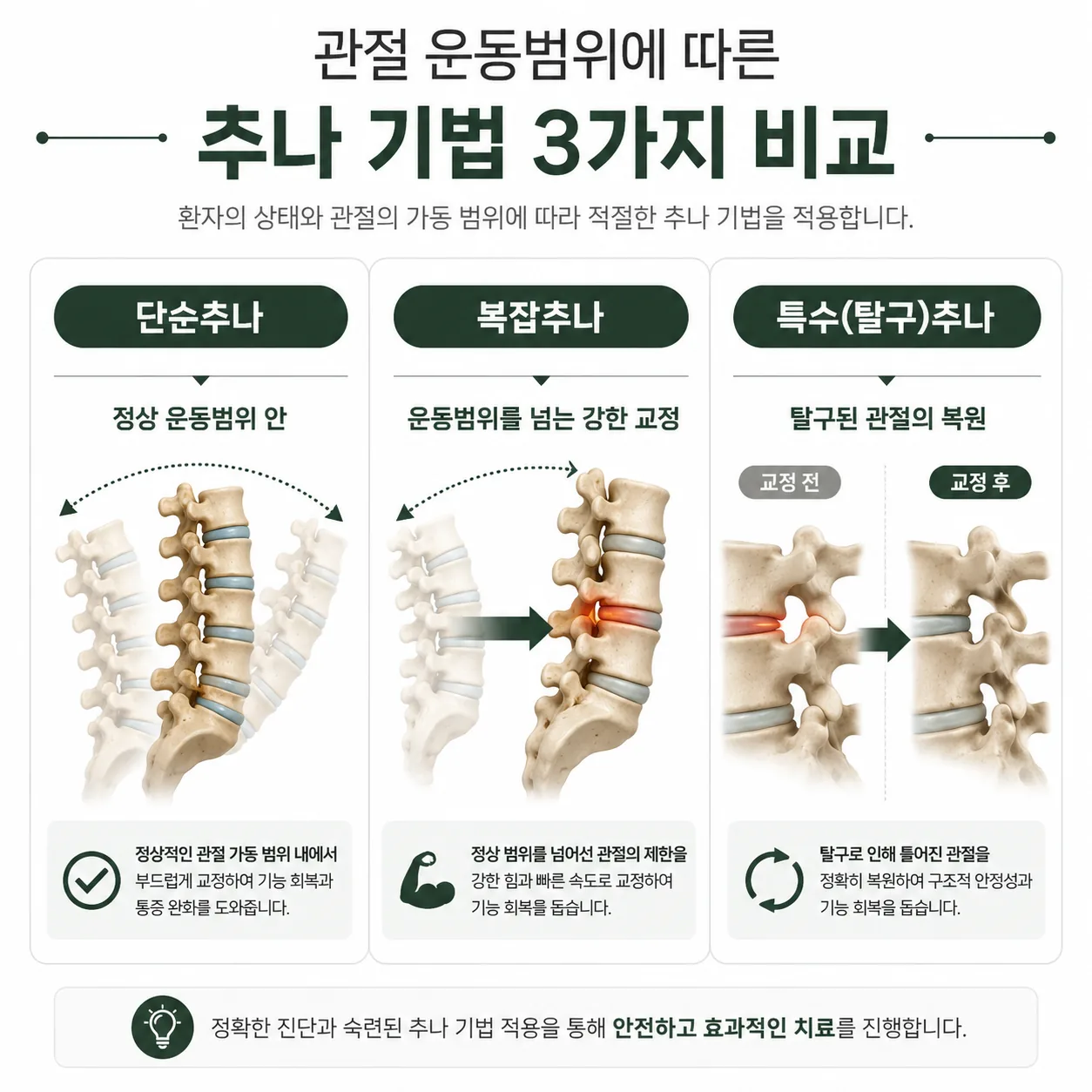 단순추나 복잡추나 특수추나를 관절 운동범위 기준으로 비교한 도식
