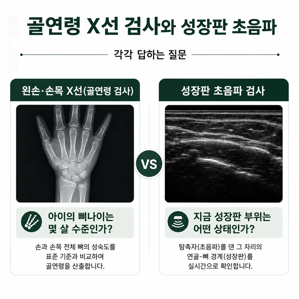 골연령 X선 검사와 성장판 초음파가 각각 답하는 질문을 비교한 도식